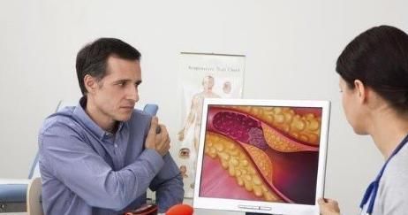 斑块|血管斑块脱落可导致“猝死”,如何有效预防斑块脱落?早知早受益