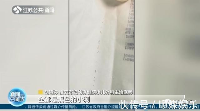 小婷|3岁女童一掌拍在仙人球上,家人处理方式让她的手肿成“小熊掌”