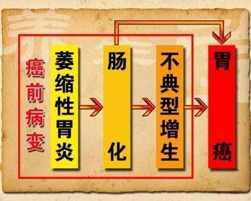 肠上皮化生|胃镜报告显示“肠化”，我会得癌吗？