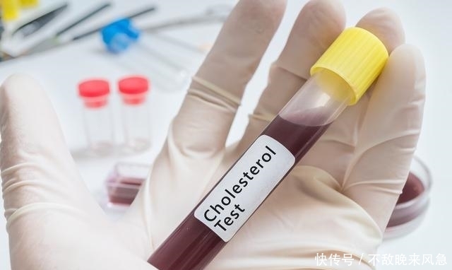 脑梗|冬至来临,如何预防脑梗发作?看看神经内科医生怎么说!