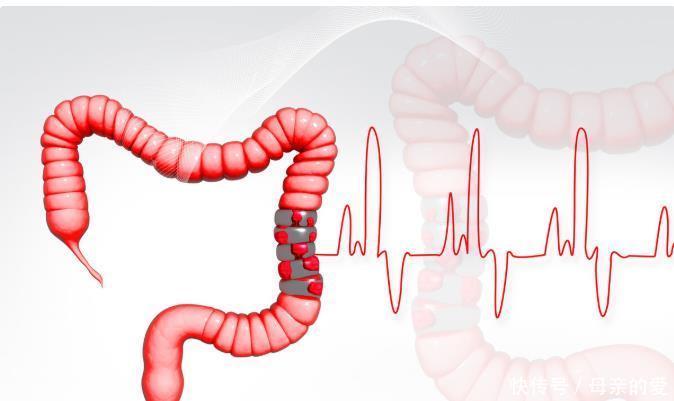 放射治疗|大肠癌会有哪些表现？如何诊断大肠癌？