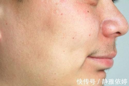 回事|36岁女子天天跑步，身体没变好，衰老还加速了，是怎么回事？