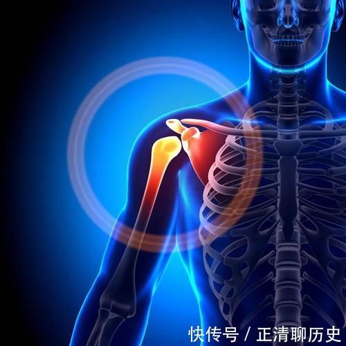 为什么不到五十岁就有五十肩?应该如何缓解?