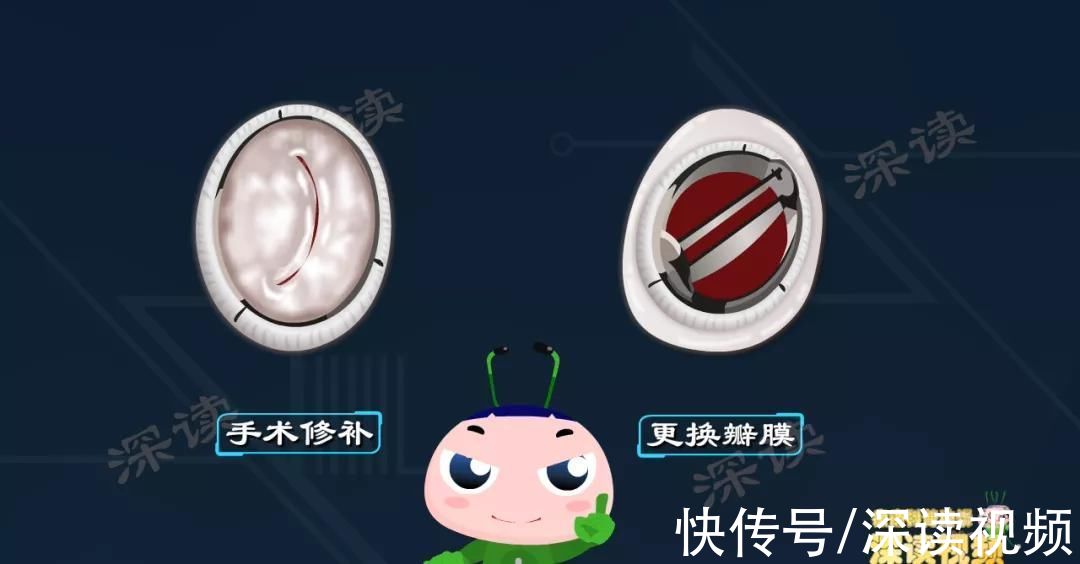 脸红心跳？呼吸费劲？腿软无力？万恶的风心病，每年祸害28万人