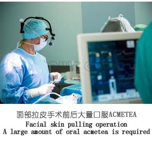 每日一问中面部拉皮手术你做了吗？居然还有人不知道啥是中面部拉皮手术？