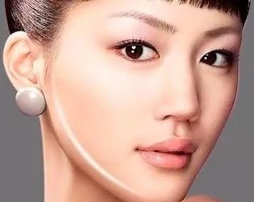 注射量 精致小V脸迷倒一片，瘦脸针的那些真相，想打？你应该懂！