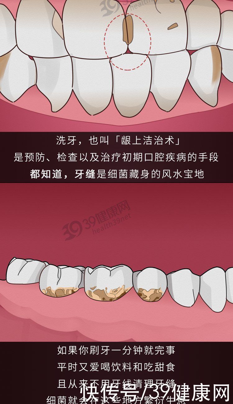 中华|不洗牙，你永远不知道牙齿里面有多脏！看完这篇就拿定主意了