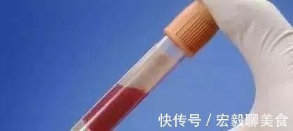 检查|长期服用他汀类降脂药,要定期去医院做这4个检查,很重要