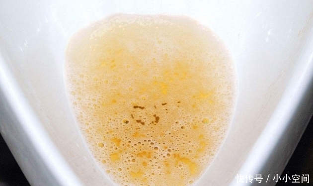 前列腺|男人晨起“第一次小便”,若没这3种表现,可能肾脏很强壮!