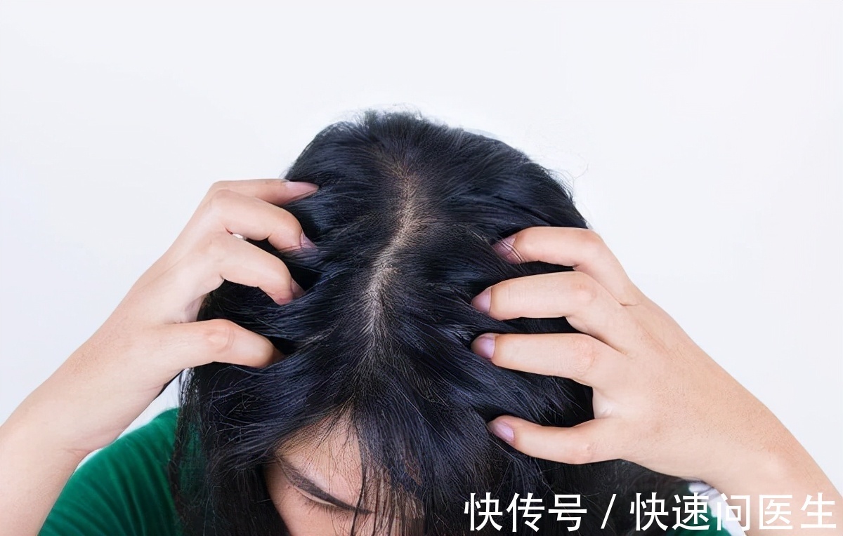 出油|为什么头发总是爱出油?明白这6个原因,别让头发越洗越油