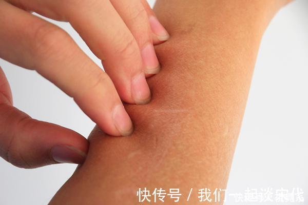 皮下出血|肺癌早期,总是不痛不痒提醒皮肤有“突变”,及时做检查