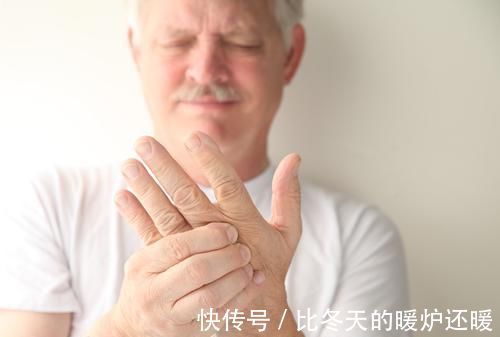 酒精性肝硬化|有没有肝硬化，看看身上有没有这种痣，长期喝酒的人不妨自测一下