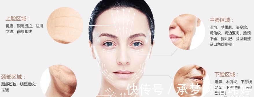 蛋白线|看完这个,你还敢做线雕隆鼻吗?