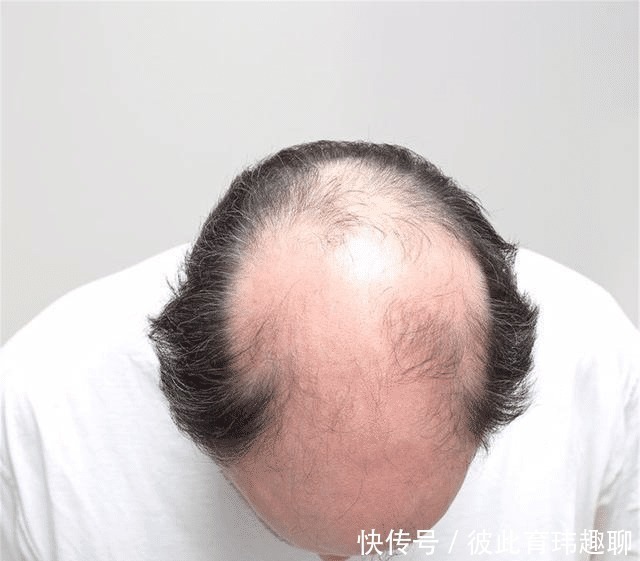 腰部|男性进入更年期的7大“丑态”,你占了几个?一项运动或能拯救你