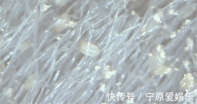 臭味|毛巾酸臭味从何而来别再用“臭毛巾”擦脸了！快来看看毛巾多脏