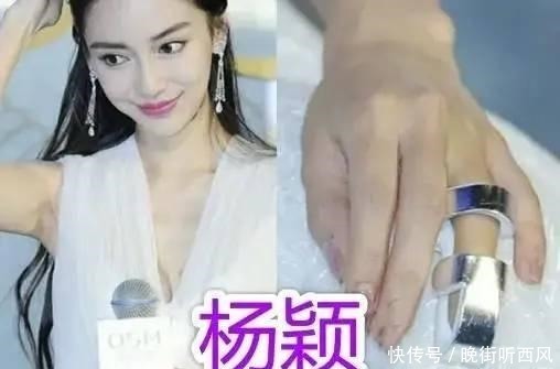 录综艺危险多邓超打石膏、鹿晗伤病，而他血流不止！