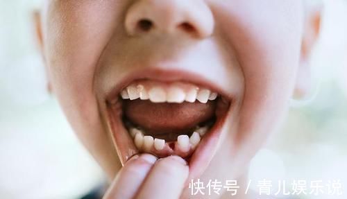 孩子|孩子脱落的乳牙真能救命?看看权威机构的说法:这些常识父母要知