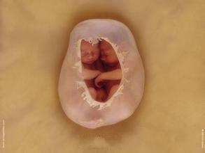 重症监护室|女子怀孕11个月还不发动,医生强行剖腹,孩子出生后全家泣不成声