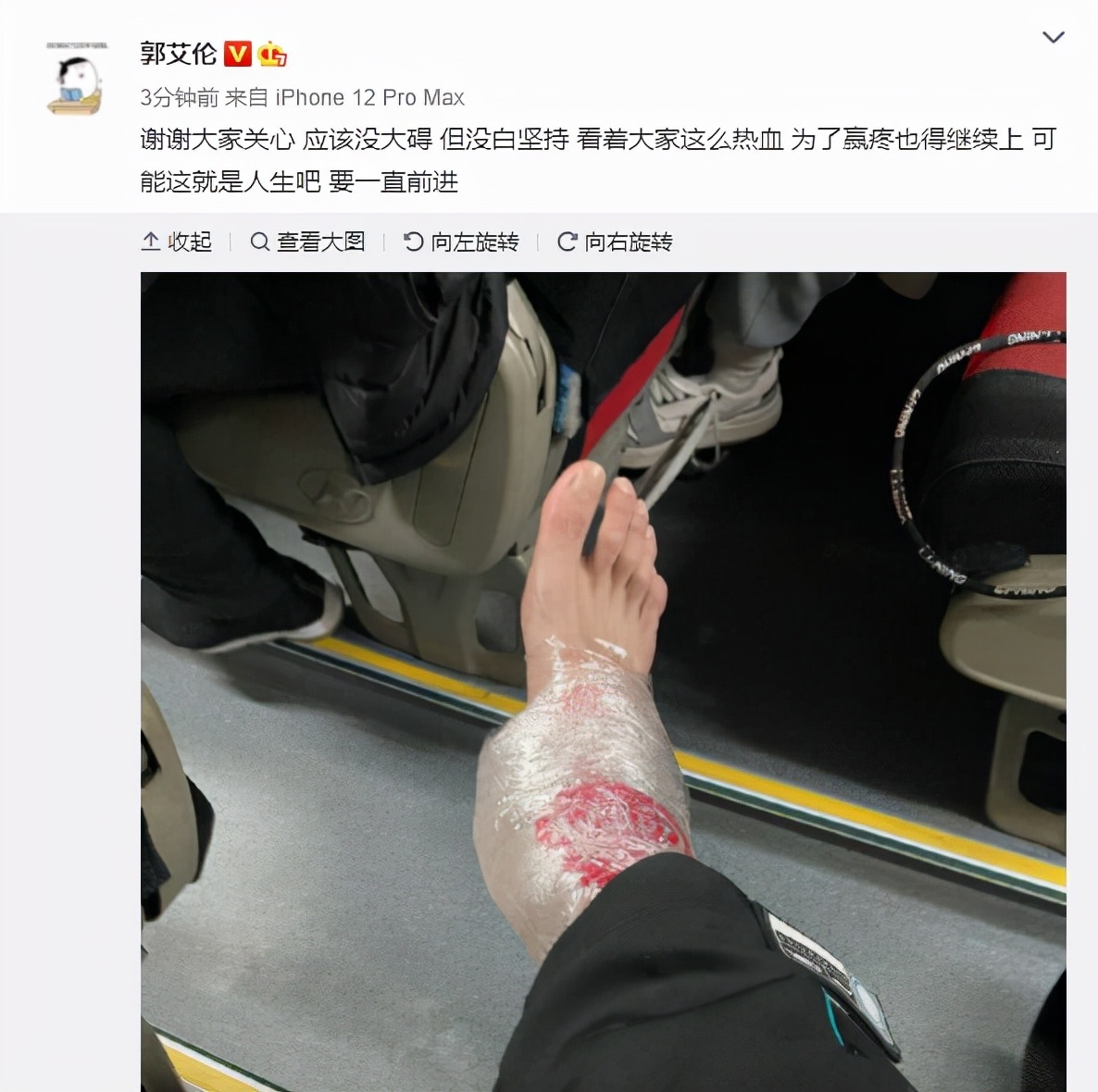 怒斥|郭艾伦赛后采访怒斥胡明轩:投篮时撤下脚,都是朋友得互相保护