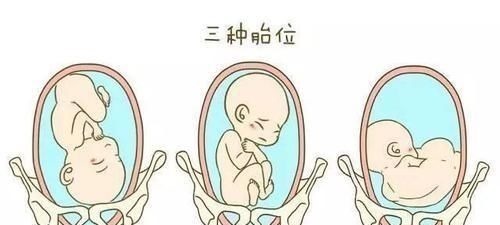 顺产|女人可以做几次剖腹产不是三次和五次,医生不要超过这个数