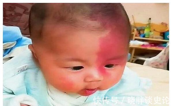 小女孩|宝宝的胎记怎么来的？产科医生：孕期这2种行为易长胎记，要避开