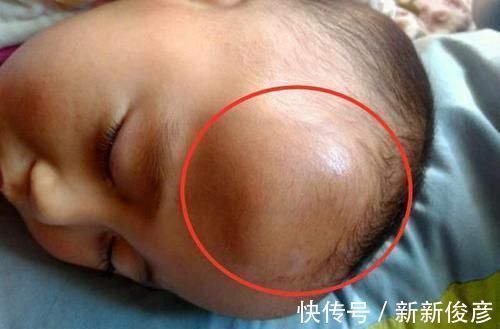 水银|5岁儿子误吞水银,爸爸急着送医院,妈妈却坚持让孩子吃半碗韭菜