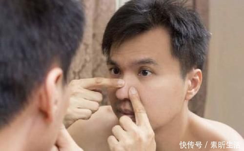 洗脸|为什么不建议你用火山泥洗面奶?说是祛痘王牌,其实是烂脸神器