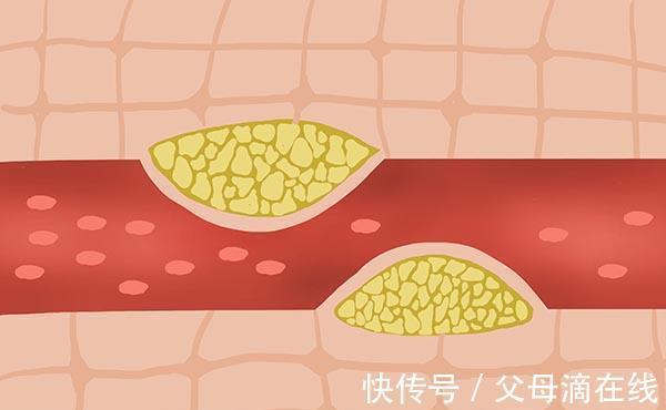 身体|老人常说“一勺猪油顶五副药”，有道理吗？经常吃猪油身体如何？
