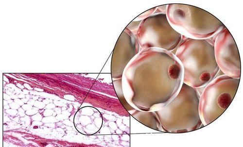 玉桑清茶|血液粘稠,易突发栓塞,1个“秘诀”疏通血管,把血管“洗”干净