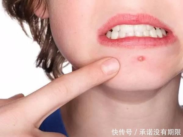 护肤|还在跟着美妆博主学护肤的小姐姐们,你们的脸还好吗