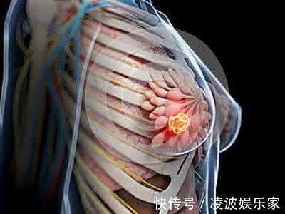 哺乳|哺乳期换上了乳腺炎,究竟该怎么办七种情况教您解决!