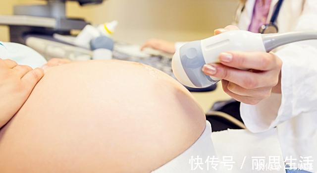 宝宝|孕期这3个坏习惯容易导致胎儿畸形,比辐射严重,很多人还在做