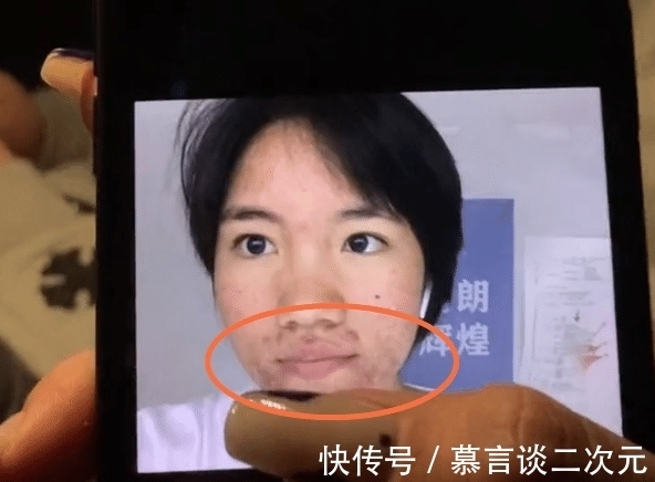 《變形計》李勒優(yōu)近照曝光,為沖刺高考剪短頭發(fā),臉上長滿痘痘