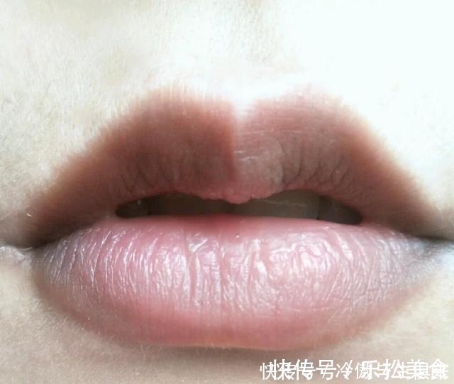 色素 女生长期涂口红,嘴巴都会有这4个问题,不解决只会拉低颜值!