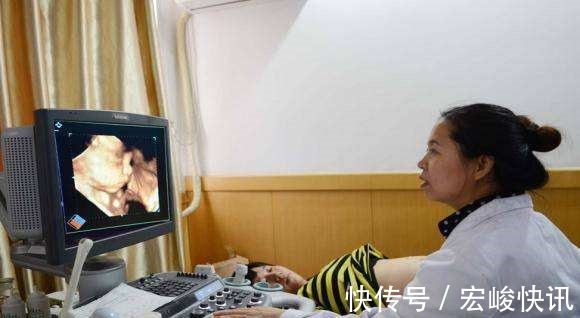 孕妈|四维彩超太难通过过来人提前做好这3件事,免得折腾太久
