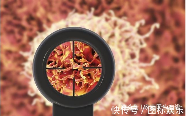 免疫功能|预防癌症复发转移，4个小建议请收好，防止癌细胞“越界”！