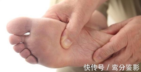 血糖|糖尿病患者:双脚有3个“变化” 血糖太高 糖尿病足来了