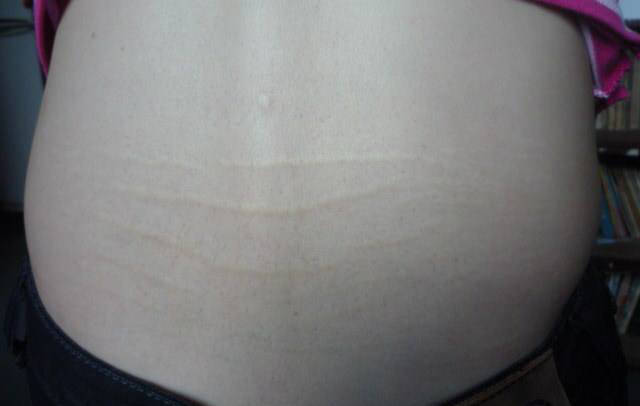 三字经|你有肾虚纹吗年过四十,肾气自半!这份养肾“三字经”请收好!