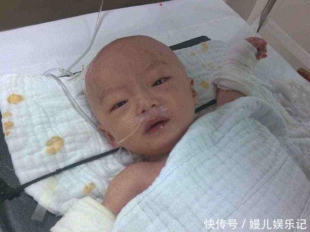 家长|孩子被烫伤,是该先脱衣服还是先冲水?一步做错,孩子伤情更严重