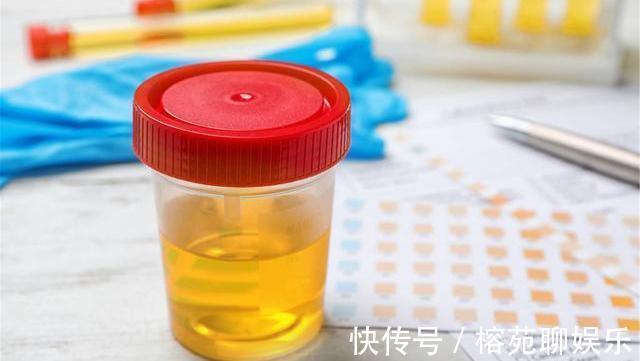 汗液|男性衰老标志一般有“1小2大3臭”，假如没有，说明你还年轻