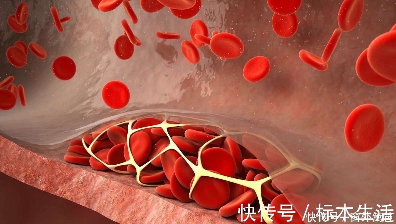 坏脂蛋白|每天吃山楂可以降血脂?北大教授:大错特错,真正降血脂的是3事