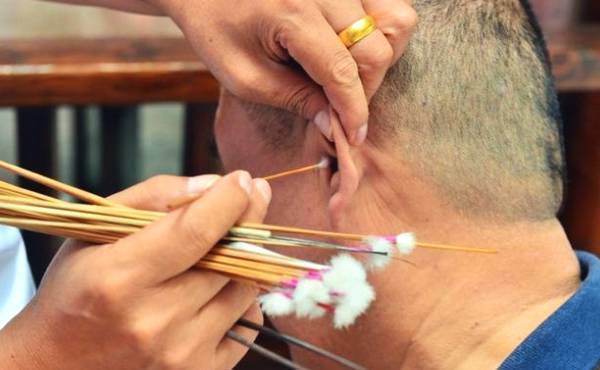 采耳需谨慎,耵聍且有且珍惜