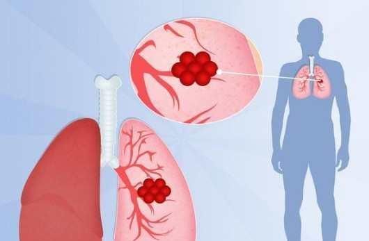 爱尔玛|五十岁后,不爱做一件事的人,身体不会太差,长寿与你有缘