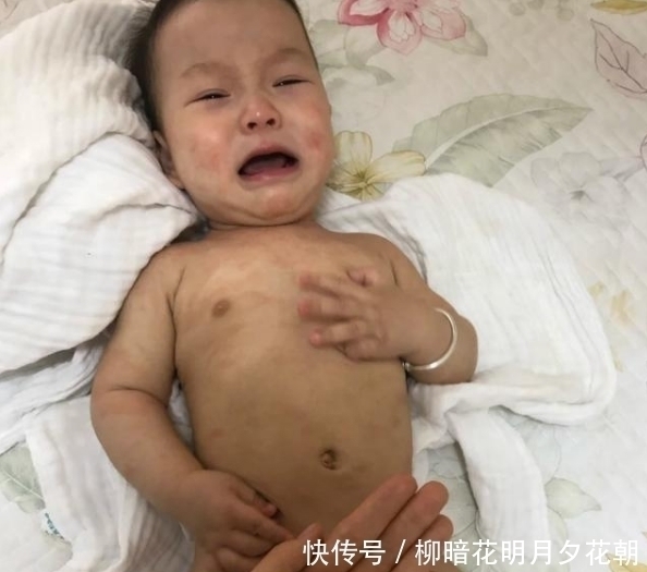 生物蛋白锌|从业50年儿科医生:食用这几物,或可预防孩子积食,帮助孩子长个