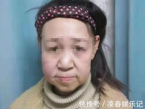 沈阳权威医院|15岁女孩竟长得像60多的老人!妈妈更让人吃惊…爸爸:这是我的宝贝!