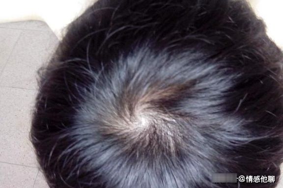 孩子的“头旋”越多,就代表越聪明?科学的解释在这里!