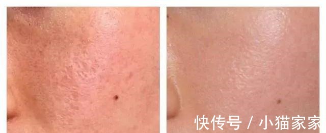 护肤品 哪些皮肤问题是护肤品不能解决的!