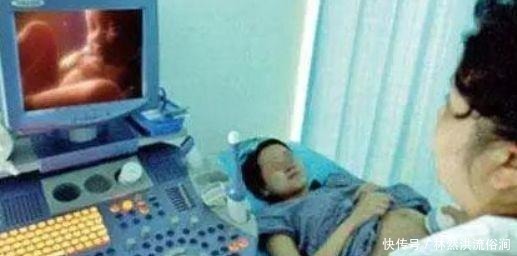 四维彩超|四维检查时,小家伙竟然在孕妈腹中干“坏事”,医生都被逗笑了