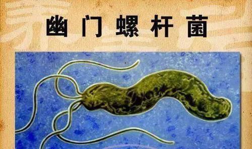 “养胃之王”，解决你的老胃病，常吃它，修复胃黏膜，胃病自己好