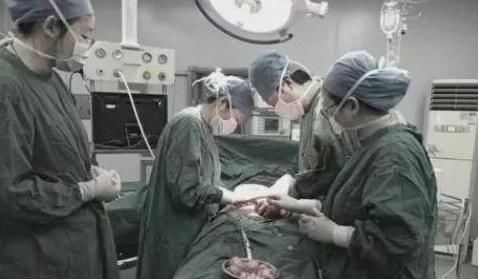 子宫|38岁女性腹痛不止,大夫在她子宫里取出大大小小61个,从未遇到过